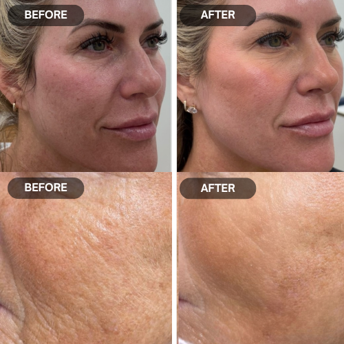 Deep Collagen Korean Glass Mask 3.0