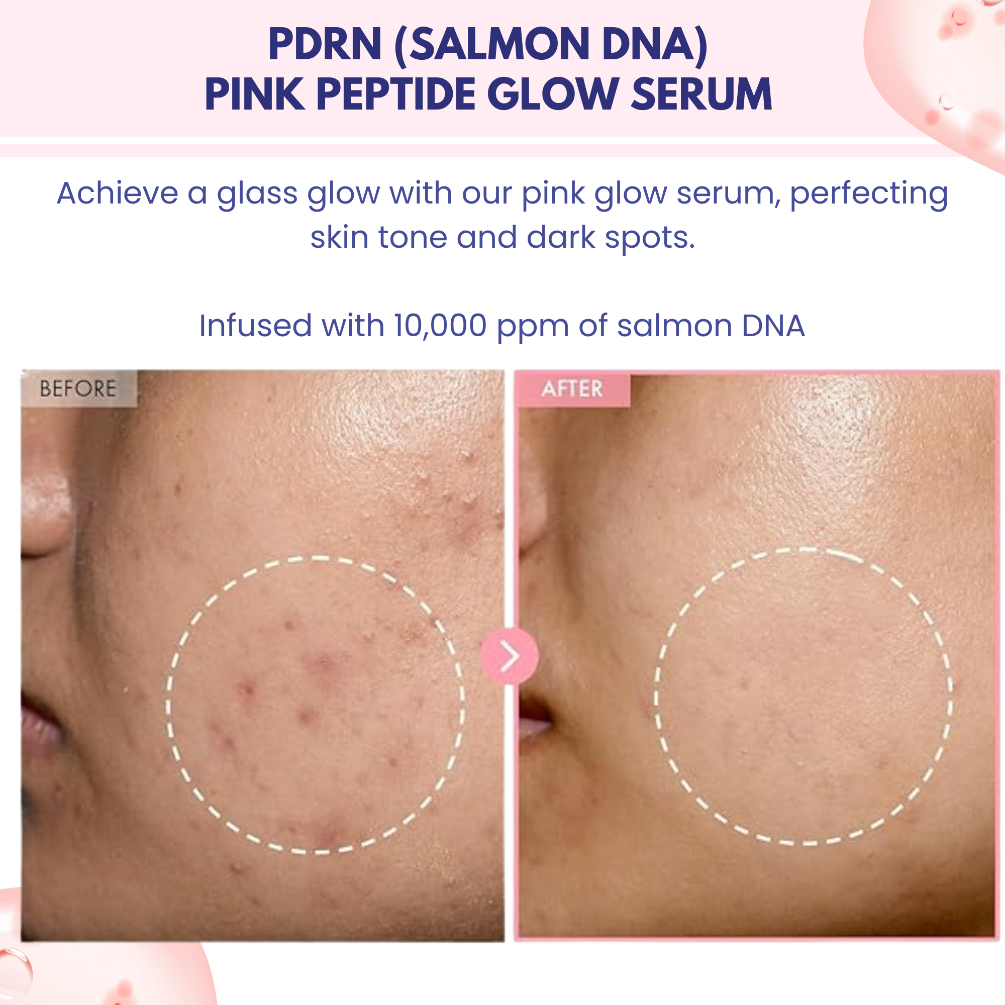 Pink PDRN Glow Serum