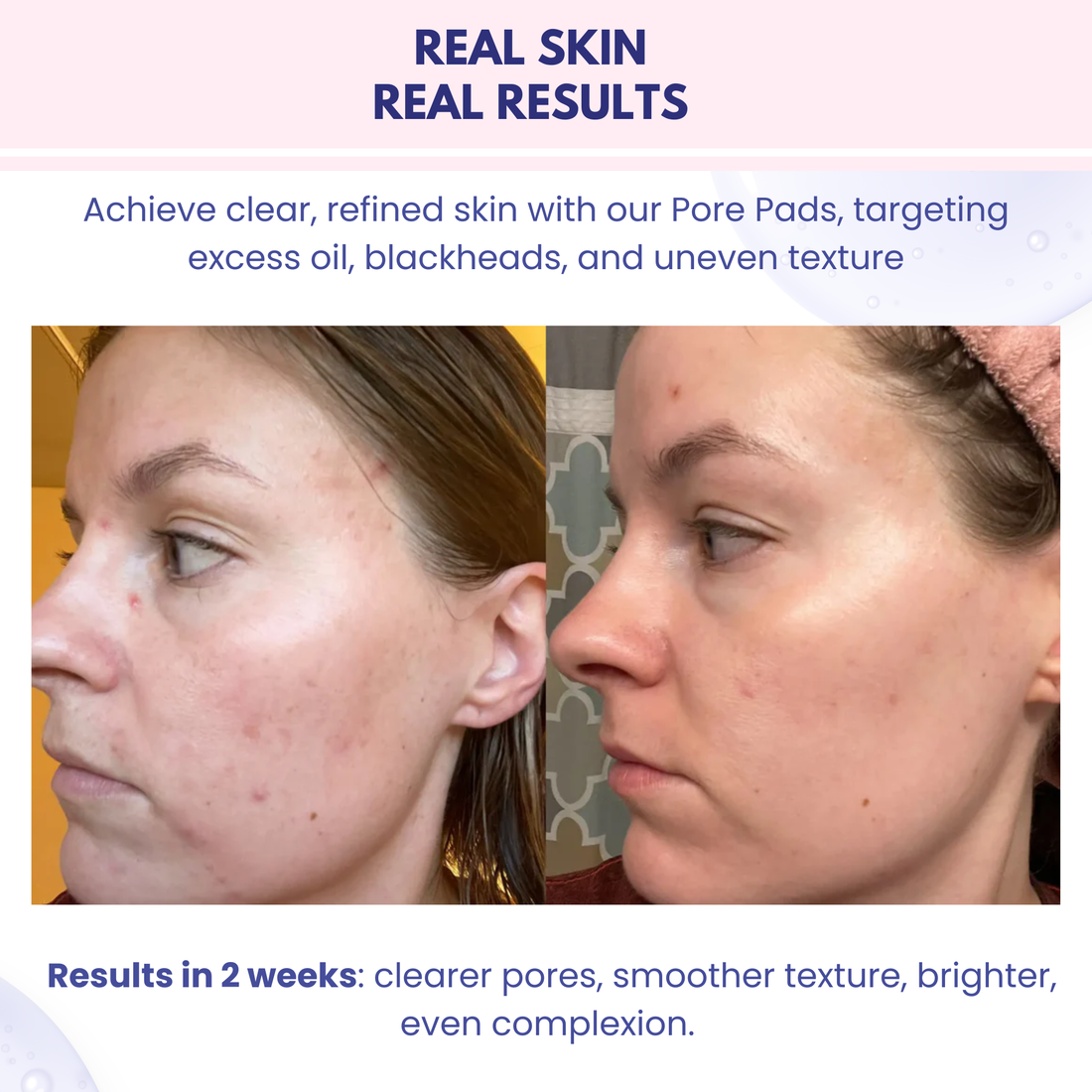 Pure Glow Pore Pad